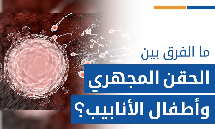 الفرق بين أطفال الأنابيب والحقن المجهري