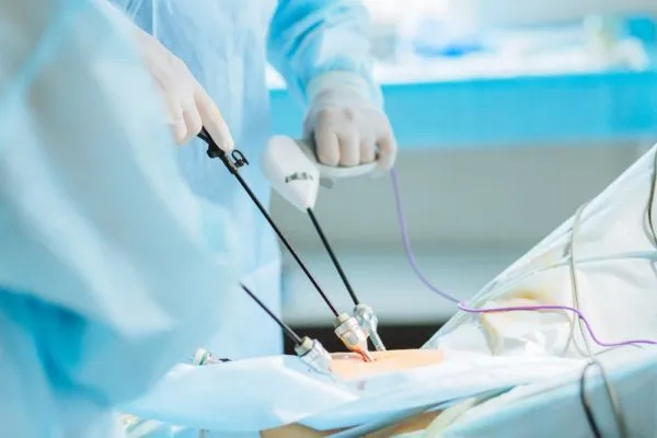 منظار البطن لعلاج تأخر الحمل وتشخيص مشكلات الخصوبة